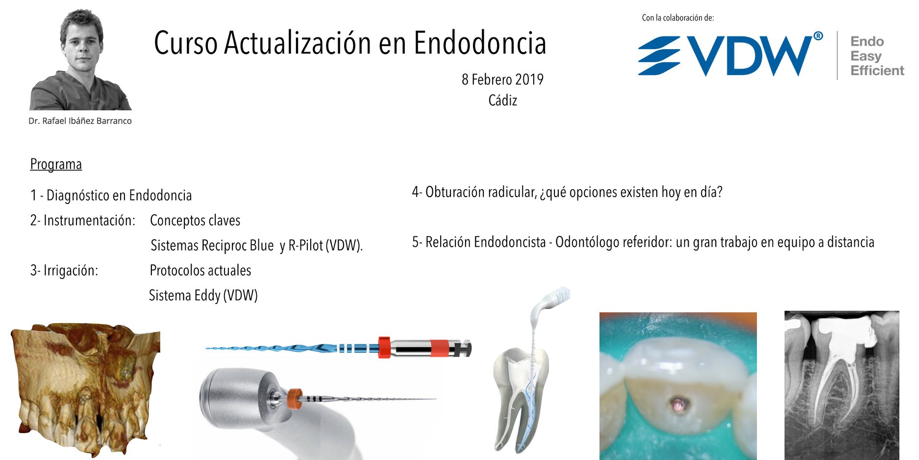 Curso Actualización en Endodoncia